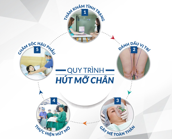 Bệnh viện Thẩm mỹ Hàn Quốc KIM có áp dụng công nghệ hút mỡ nội soi bằng laser lipo tiên tiến nhất hiện nay. Quy trình hút mỡ bắp tay, bắp chân đúng quy trình chuẩn tại Bệnh viện KIM